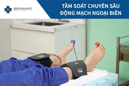 Tầm soát chuyên sâu động mạch ngoại biên